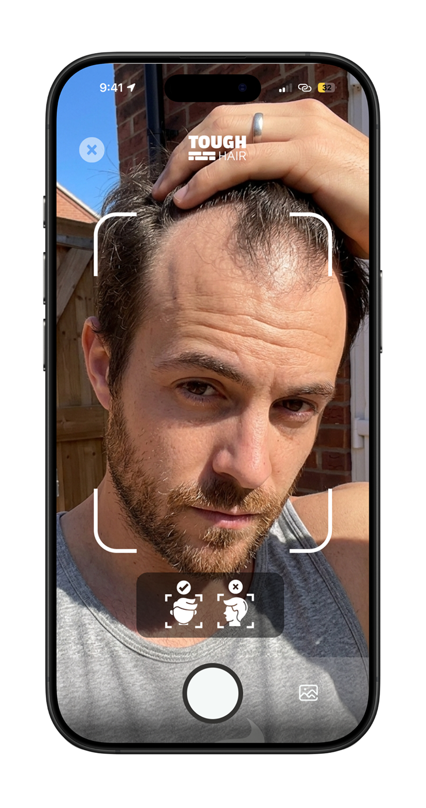 Before: hair loss assessment